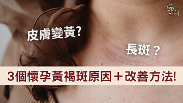 Pregnancy melasma causes and solutions; close-up of skin discoloration and dark spots during pregnancy